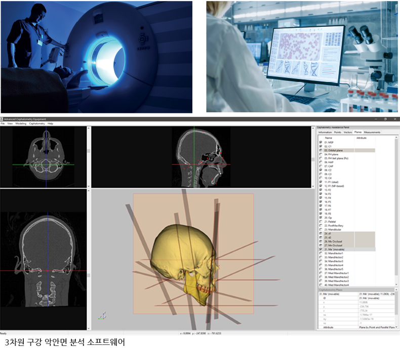 3차원 구강 악안면 분석 소프트웨어
