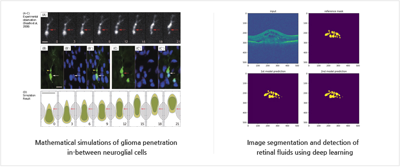 Mathematical simulations of glioma penetration 
in-between neuroglial cells