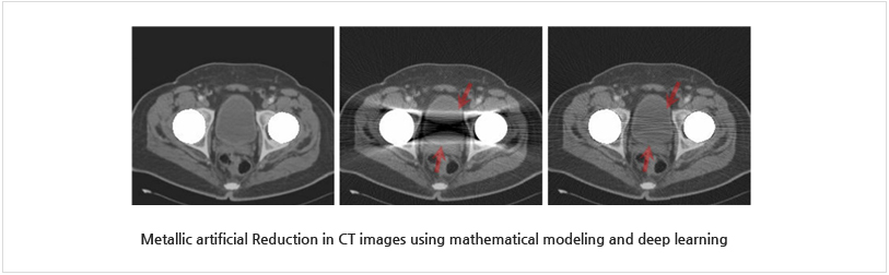 Metallic artificial Reduction in CT images using mathematical modeling and deep learning