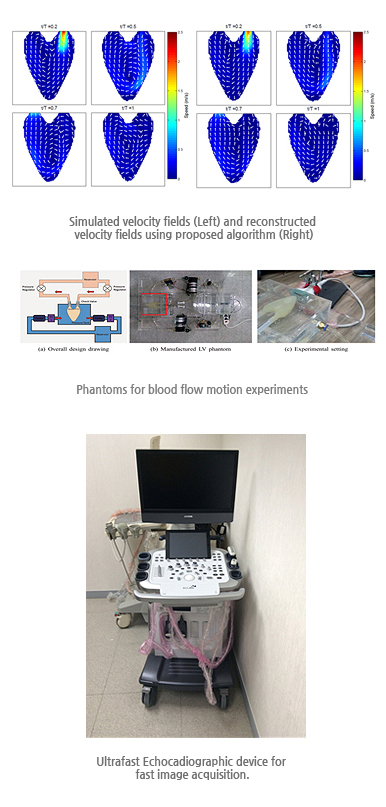 Simulated Velocity fields and reconstruceted velocity fields using proposed algorithm, phantoms for blood flow motion experiments, Ultrafast Echocadiographic device for fast image acquisition
