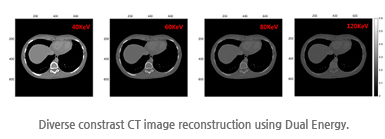 Diverse constrast CT image reconstruction using Dual Energy