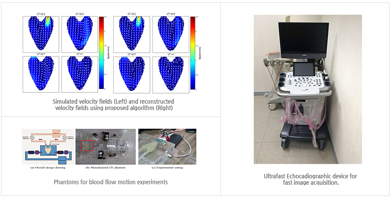 Simulated Velocity fields and reconstruceted velocity fields using proposed algorithm, phantoms for blood flow motion experiments, Ultrafast Echocadiographic device for fast image acquisition