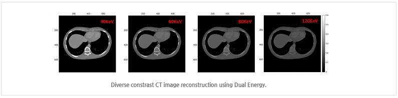 Diverse constrast CT image reconstruction using Dual Energy