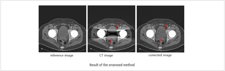 Result of the proposed method